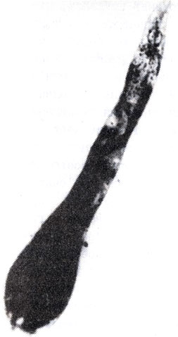 Рис. 5. Самка М.incognita бутылковидной (а) и грушевидной (б) формы