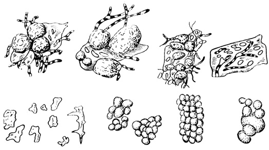 Гидраты окислов железа: диатомовые водоросли и фитолитарии (в корочках выветривания на скалах Тянь-Шаня)