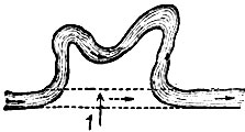 Рис. 1. Спрямление русла: 1 - прокоп, спрямляющий извилину реки