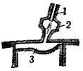 Рис 3. Схема предкамерного распиливания: 1 - форсунка; 2 - предкамера; 3 - камера сгорания