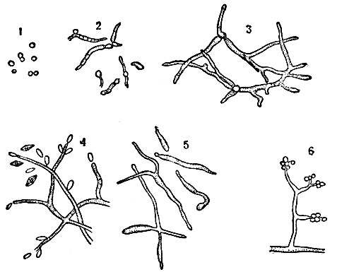Возбудитель белой мускардины тутового шелкопряда: 1 - конидии; 2 - прорастание конидий; 3 - мицелий; 4 - споры, отпочковывающиеся в теле гусеницы от мицелия; 5 - отростки грибка (геммы); 6 - конидиальное плодоношение