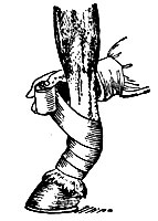 Рис. 4. Спиральная повязка на конечности