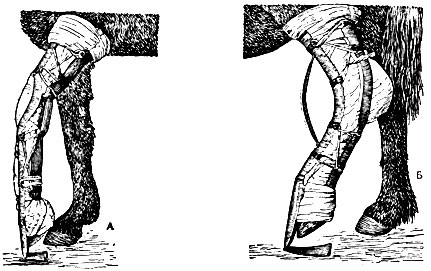 Рис. 7. Иммобилизирующие шины системы Африканова: А - для грудной конечности; Б - для тазовой конечности