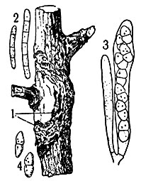 Рис. 1. Рак яблони: 1 - поражённая кора; 2 - конидиальные споры; 3 - зрелая и невызревшая сумки; 4 - две аскоспоры (1 - уменьшено; 2, 3, 4 - увеличено под микроскопом)