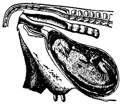 Рис. 1. Нормальное внутриматочное положение телёнка