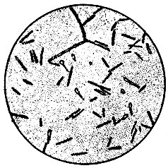 Рис. 1. Бациллы столбняка (видны характерные формы барабанных палочек)