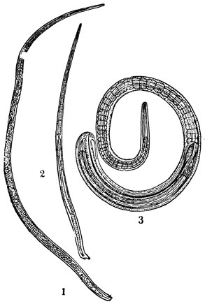 Рис 1. Трихинелла (увеличено): 1 - самка; 2 - самец; 3 - личинка